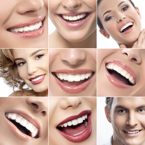 smiech3